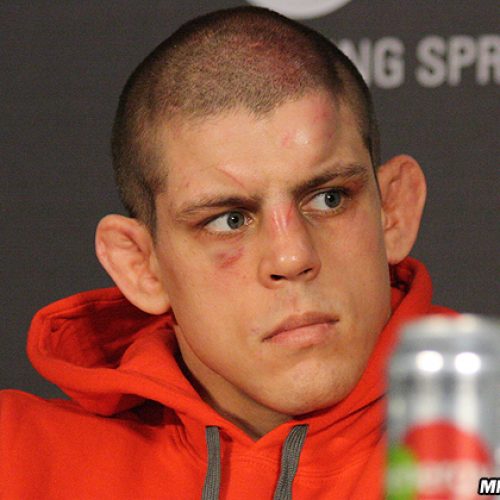 joe-lauzon-ufc-on-fox-91